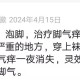 用柳树叶治脚气止痒的方法